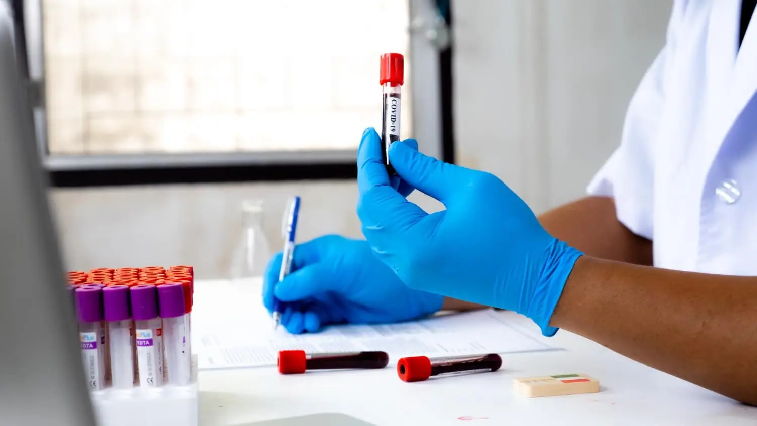 laboratory technician collecting blood samples using test tubes during a laboratory analysis